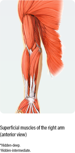 medical diagram with an anterior view showing how to dose and administer dysport for superficial muscles of the right arm in adults with upper limb spasticity
