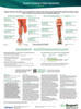 Adult Spasticity Muscle Poster